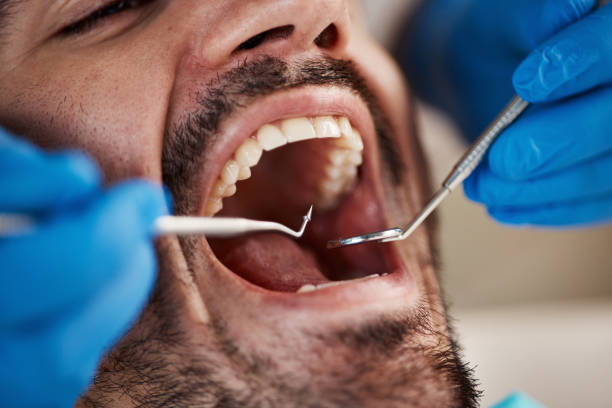 Oral Surgery in Fayetteville, AL